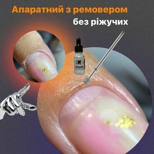 Апаратний 2ма фрезами з використанням ремоверу.Спосіб коли фреза не зрізає спідничку k1 фото